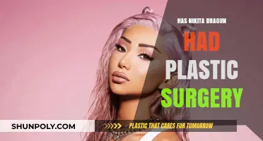 Nikita Dragun's Transformation: Plastic Surgery Speculations and Truths