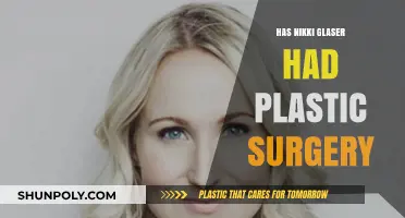 Nikki Glaser's Transformation: Plastic Surgery Speculations and Truths Revealed