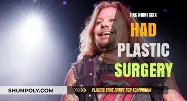 Nikki Sixx Plastic Surgery: Fact-Checking the Rocker's Transformation Rumors