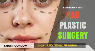 Nikkietutorials Plastic Surgery: Unveiling the Truth Behind Her Transformation