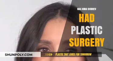 Nina Dobrev's Transformation: Plastic Surgery Rumors Explored and Debunked