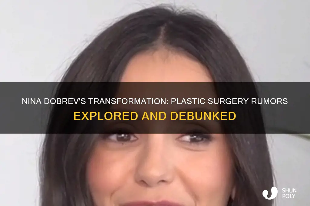 has nina dobrev had plastic surgery