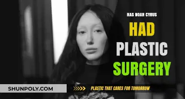 Noah Cyrus Plastic Surgery: Fact-Checking Her Transformation Rumors