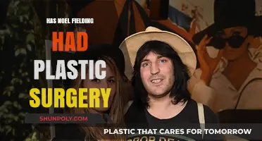 Has Noel Fielding Had Plastic Surgery? Unveiling the Truth
