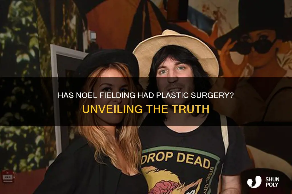 has noel fielding had plastic surgery