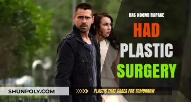 Noomi Rapace Plastic Surgery: Fact or Fiction? Unveiling the Truth