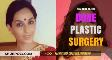 Nora Fatehi's Transformation: Plastic Surgery Rumors Explored and Debunked