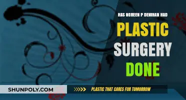 Noreen P. Denihan's Appearance: Plastic Surgery Speculations Explored
