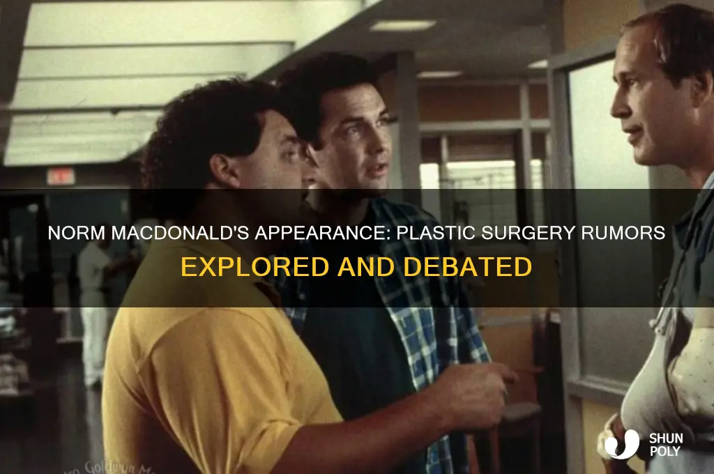 has norm macdonald had plastic surgery