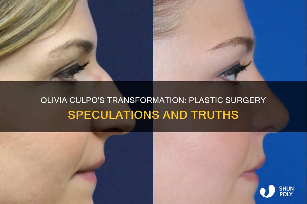 has olivia culpo had plastic surgery