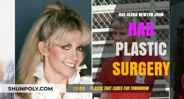 Olivia Newton-John's Transformation: Plastic Surgery Speculations and Truths