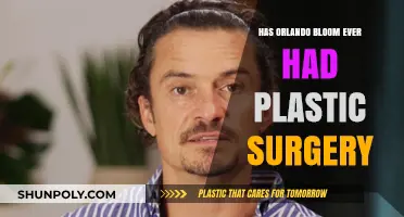 Orlando Bloom's Transformation: Plastic Surgery Rumors Explored and Debunked