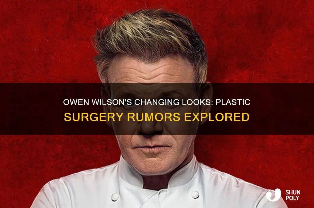 has owen wilson had plastic surgery
