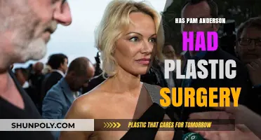 Pam Anderson's Transformation: Plastic Surgery Rumors and Reality Revealed
