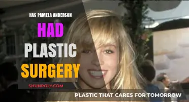 Pamela Anderson's Transformation: Plastic Surgery Speculations and Truths Revealed