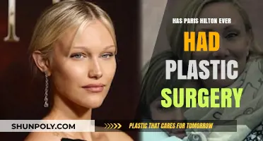 Paris Hilton's Plastic Surgery: Fact or Fiction? Unveiling the Truth