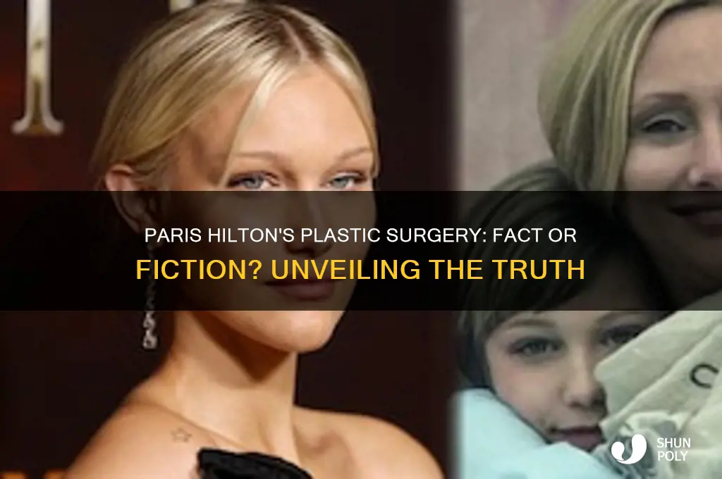 has paris hilton ever had plastic surgery