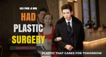 Park Ji Min's Transformation: Plastic Surgery Rumors Explored