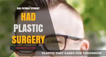 Has Patrick Stewart Had Plastic Surgery? Unveiling the Truth