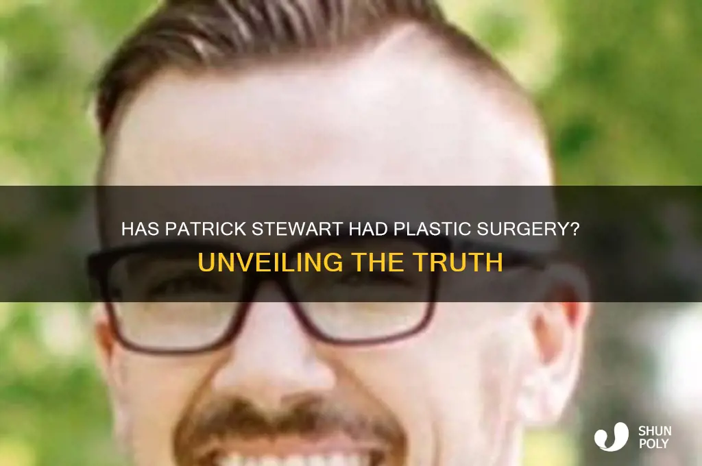 has patrick stewart had plastic surgery