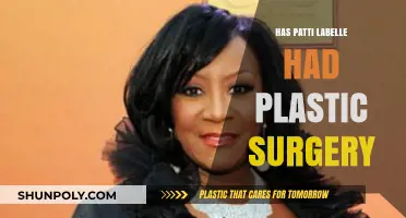 Patti LaBelle's Transformation: Plastic Surgery Rumors and Reality Revealed