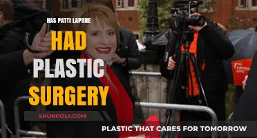 Patti LaPone's Appearance: Plastic Surgery Speculations and Truths