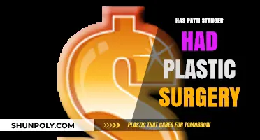 Patti Stanger's Transformation: Plastic Surgery Rumors Explored