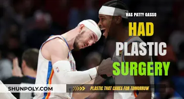 Patty Gasso Plastic Surgery: Fact-Checking the Rumors and Speculations