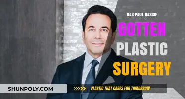Has Paul Nassif Had Plastic Surgery? Uncovering the Truth