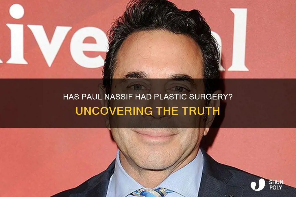 has paul nassif gotten plastic surgery