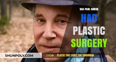 Paul Simon's Appearance: Plastic Surgery Speculations and Facts Revealed