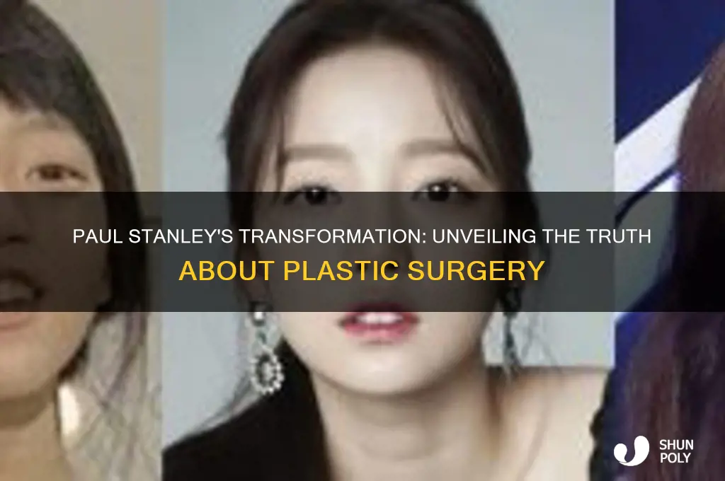 has paul stanley had plastic surgery