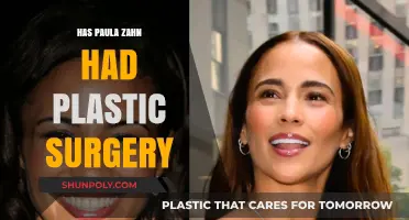 Paula Zahn's Transformation: Plastic Surgery Rumors and Speculations