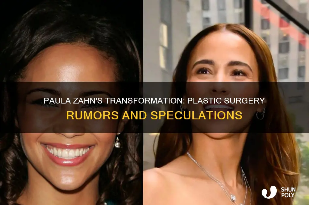 has paula zahn had plastic surgery