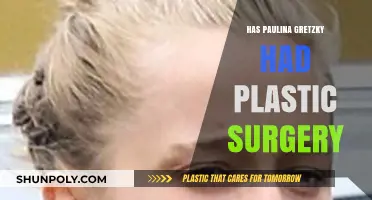 Paulina Gretzky's Transformation: Plastic Surgery Rumors and Reality