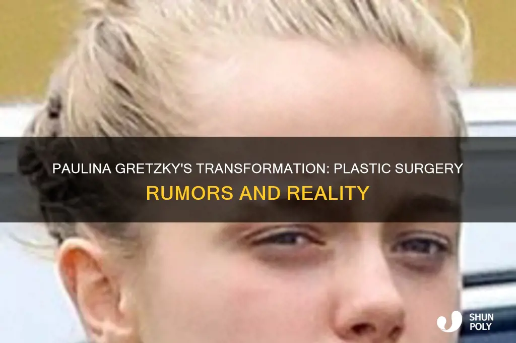 has paulina gretzky had plastic surgery