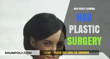 Has Peggy Fleming Had Plastic Surgery? Uncovering the Truth