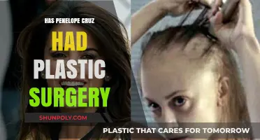 Penelope Cruz Plastic Surgery: Fact-Checking Rumors and Speculations