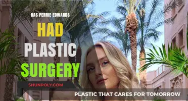 Perrie Edwards Plastic Surgery: Fact-Checking the Transformation Rumors