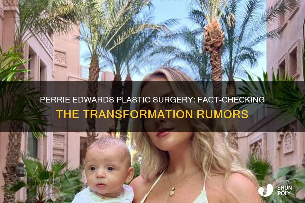 has perrie edwards had plastic surgery