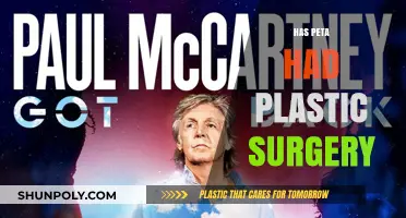 Has PETA's President Undergone Plastic Surgery? The Truth Revealed