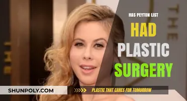 Peyton List Plastic Surgery: Fact-Checking Rumors and Speculations