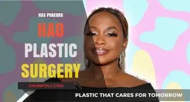 Phaedra's Transformation: Plastic Surgery Speculations and Realities Explored