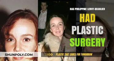 Philippine Leroy-Beaulieu's Transformation: Plastic Surgery Speculations Explored
