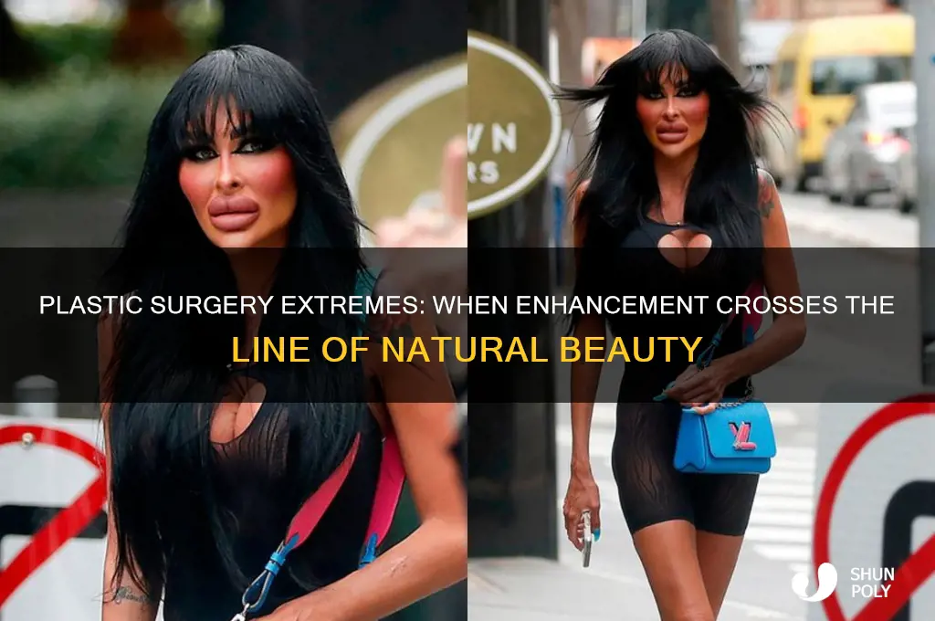 has plastic surgery gone too far