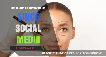 Social Media's Impact: Rising Plastic Surgery Trends Explored