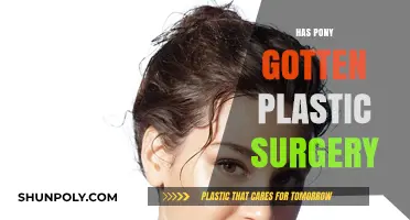 Has Pony Undergone Plastic Surgery? Analyzing the Transformation Rumors
