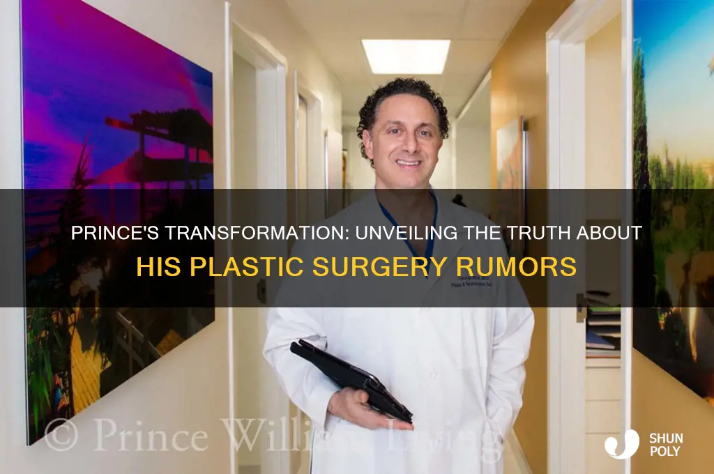 has prince had plastic surgery