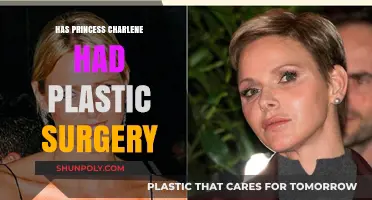 Has Princess Charlene Undergone Plastic Surgery? Unveiling the Truth