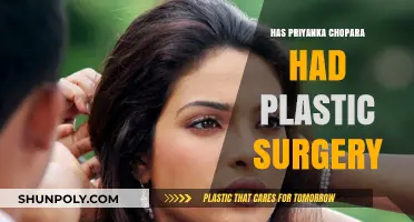 Priyanka Chopra's Transformation: Plastic Surgery Rumors Explored